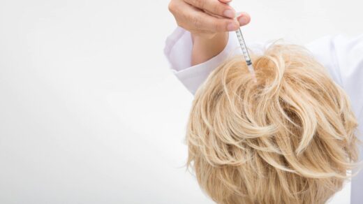 Transplantacja włosów u kobiet - opis zabiegu