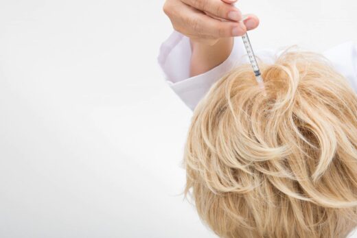 Transplantacja włosów u kobiet - opis zabiegu